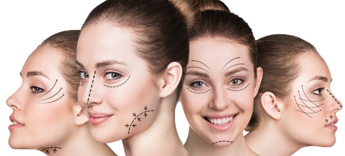 Acne scarring